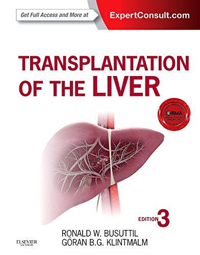 Busutil’s liver transplantation