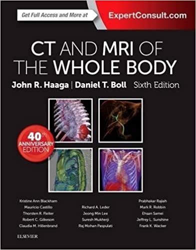 CT and MRI of the whole body by Haaga