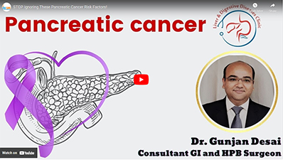 Understanding Pancreatic Cancer