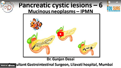 IPMN of the Pancreas