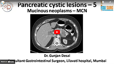 Mucinous cystic neoplasm of pancreas