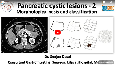 Pancreatic cystic lesions