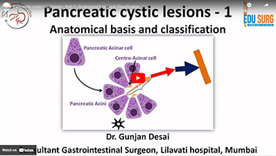 Pancreatic cystic neoplasms