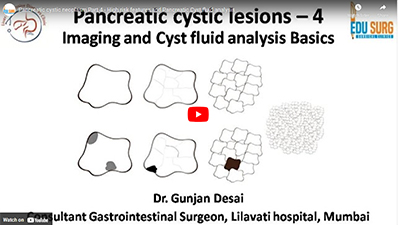 Pancreatic cystic neoplasm Part 4