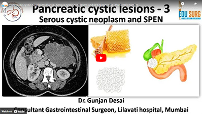 Pancreatic cystic neoplasms Part 3