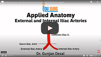 Anatomy essentials - Internal iliac artery branches, External iliac artery, May Thurner Syndrome