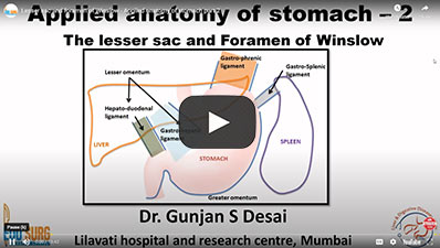 Lesser-Sac-&-Foramen-of-Winslow