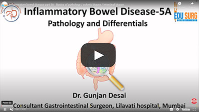 Inflammatory-bowel-disease-part-5A