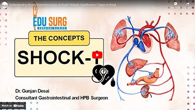 Pathophysiology of shock