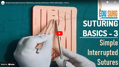 Simple interrupted sutures